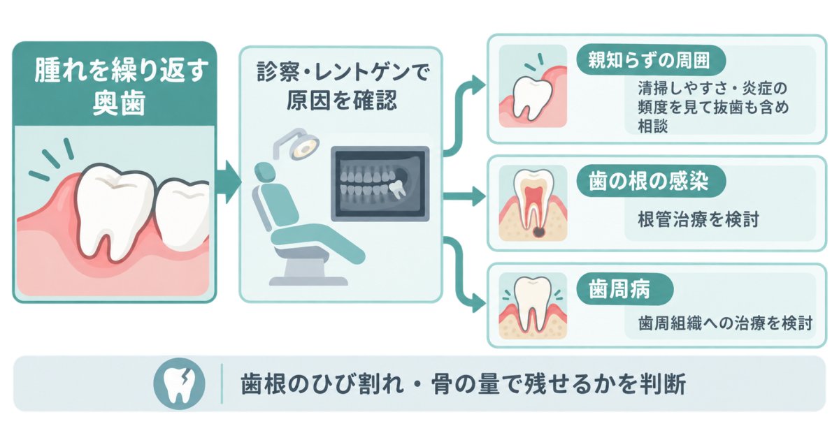 腫れを繰り返す奥歯は、抜歯しなければならない?